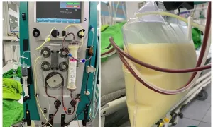 Mỡ máu cao gấp 37 lần dù không béo phì